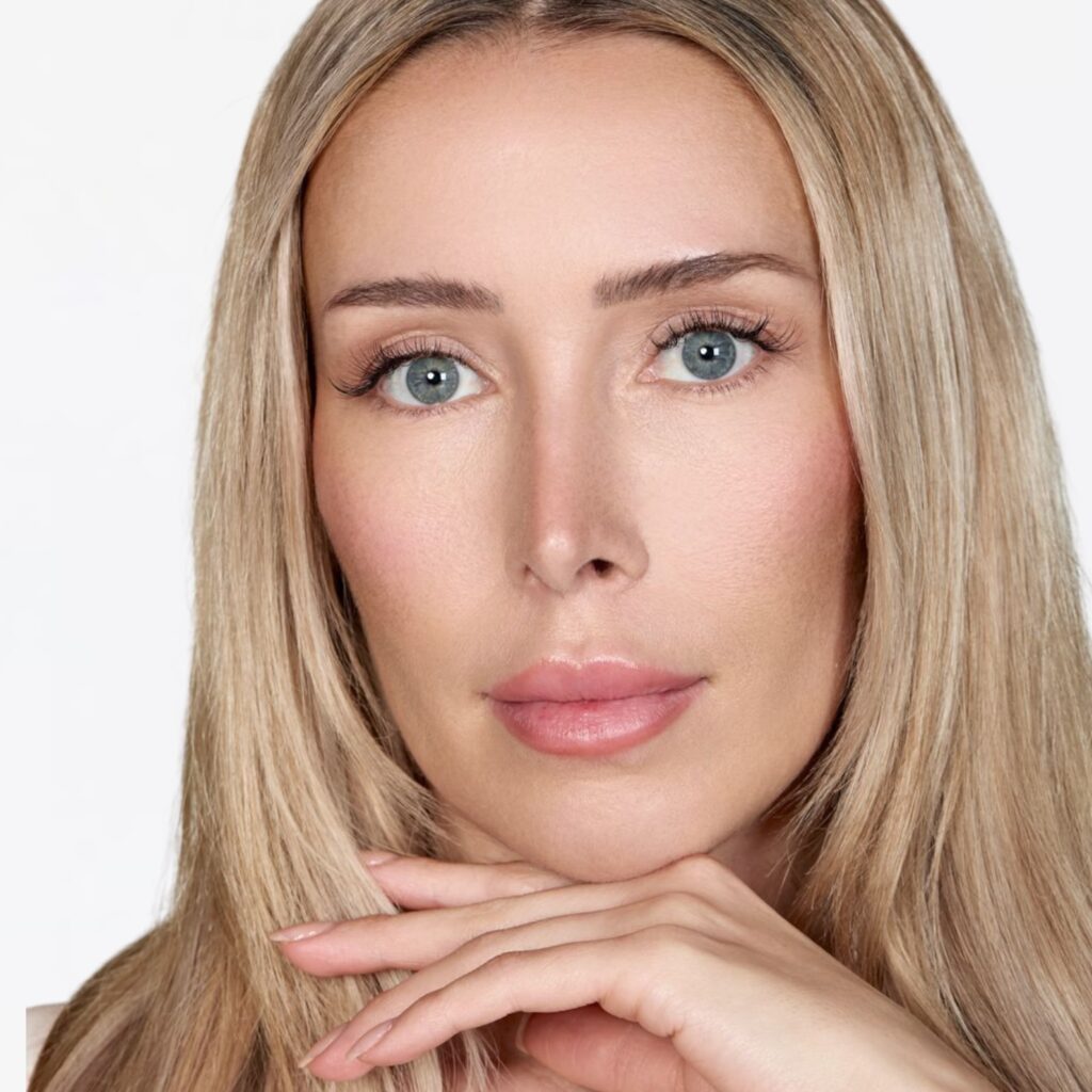 Full Face Botox Behandlung bei Natural Aesthetic Berlin