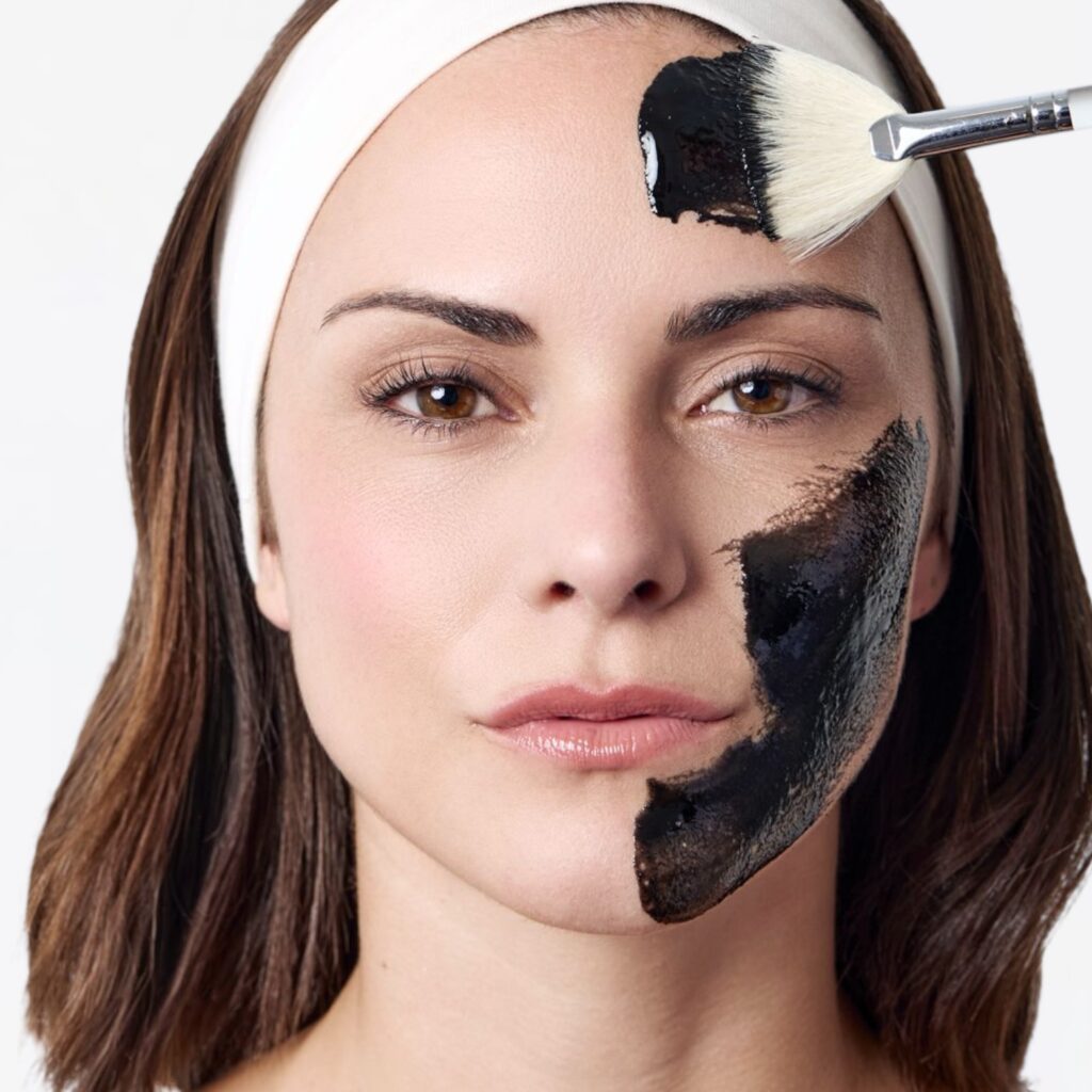 Professionelles Carbon Peeling in Berlin bei Natural Aesthetic