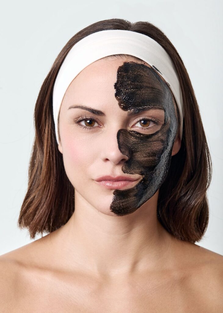 Professionelles Carbon Peeling Laser Peeling in Berlin bei Natural Aesthetic