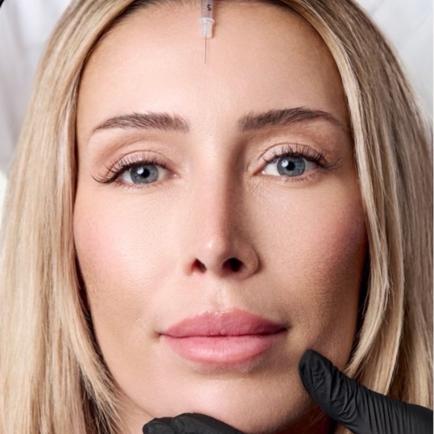 Professionelle Botox Behandlung bei Natural Aesthetic Berlin