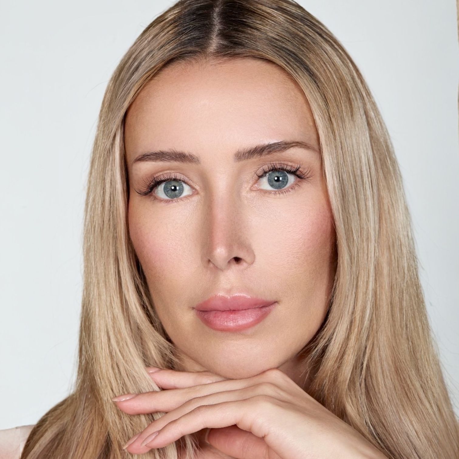Botox Behandlung Berlin | Natural Aesthetic